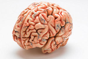 сканирование мозга