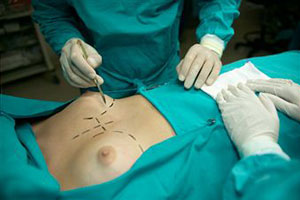 Операция на грудь