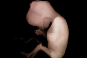 Снимок эмбриона человека