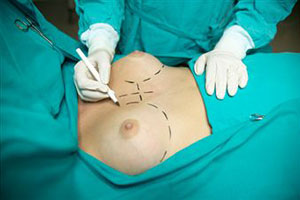 Пластическая операция груди