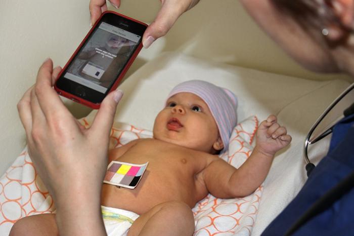 Смартфон определит желтушку у младенцев