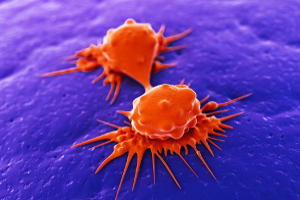 раковые клетки