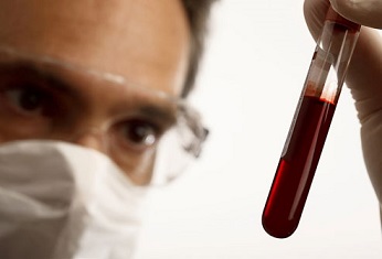 Новая методика анализа крови выявит любую инфекцию 
