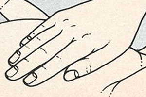 Лечение бесплодия с помощью техники Рейки рисунок