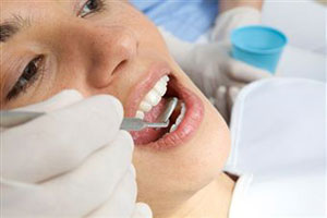 Способы отбеливания зубов 
