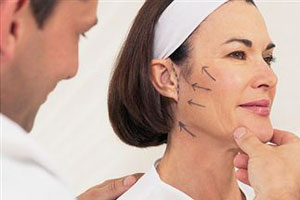 Фейслифтинг